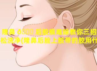 隆鼻 🐟 后胶痕难除教你三招轻松洗净(隆鼻后脸上胶带的胶用什么能擦除干净)